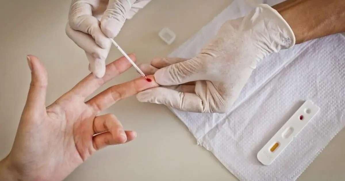 Brasil aguarda contraproposta para compra de medicamento semestral contra o HIV