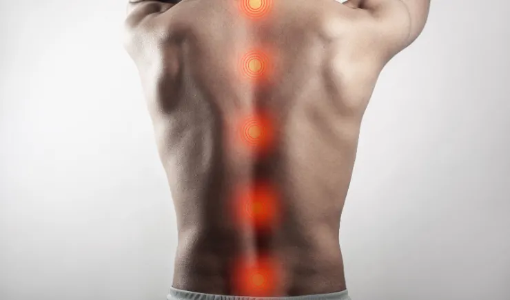 Polilaminina avança para testes em humanos e renova esperança no tratamento de lesões medulares